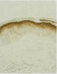 Monoclonal Mouse anti-Human TGM3 / Transglutaminase 3 Antibody (clone C2D, WB)