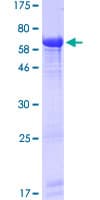 Human PCYT2 / ET Protein (Recombinant GST)