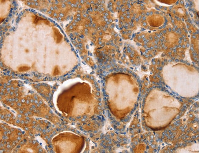 TRIM45 Antibody