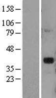DLX2 Protein (Over-Expression Lysate Myc-DDK (Flag))