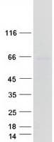 Human ARSD / Arylsulfatase D Protein (Recombinant Myc-DDK (Flag))