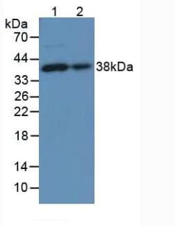 Lumican Antibody (aa19-338)