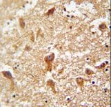 PIGX Antibody (aa67-95)