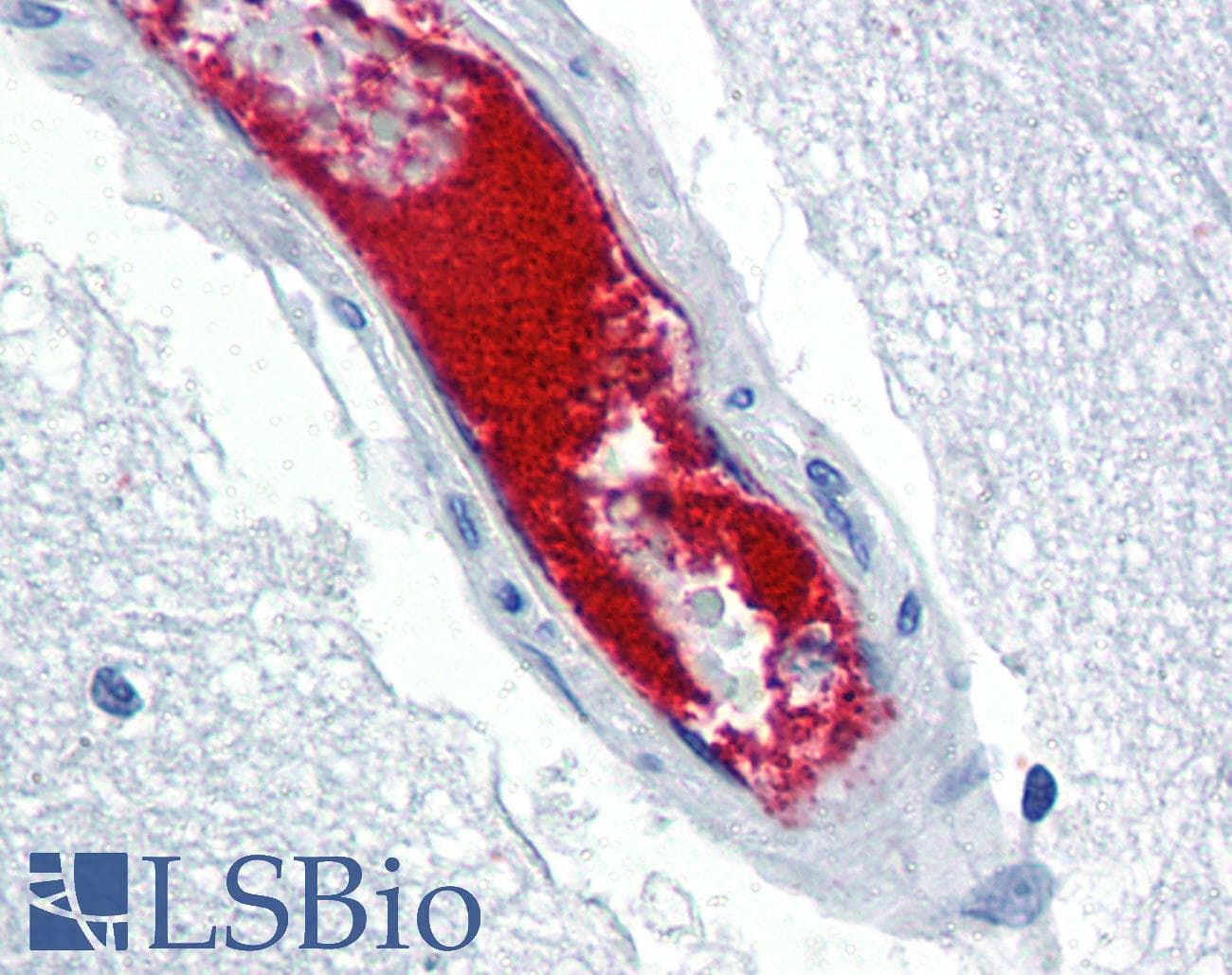 IHC-plus™ VWF / Von Willebrand Factor Antibody