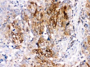 Polyclonal Rabbit anti-Human PPP1R1B / DARPP-32 Antibody (IHC, WB)