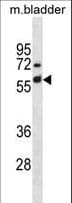KRT6A / CK6A / Cytokeratin 6A Antibody (aa212-240)