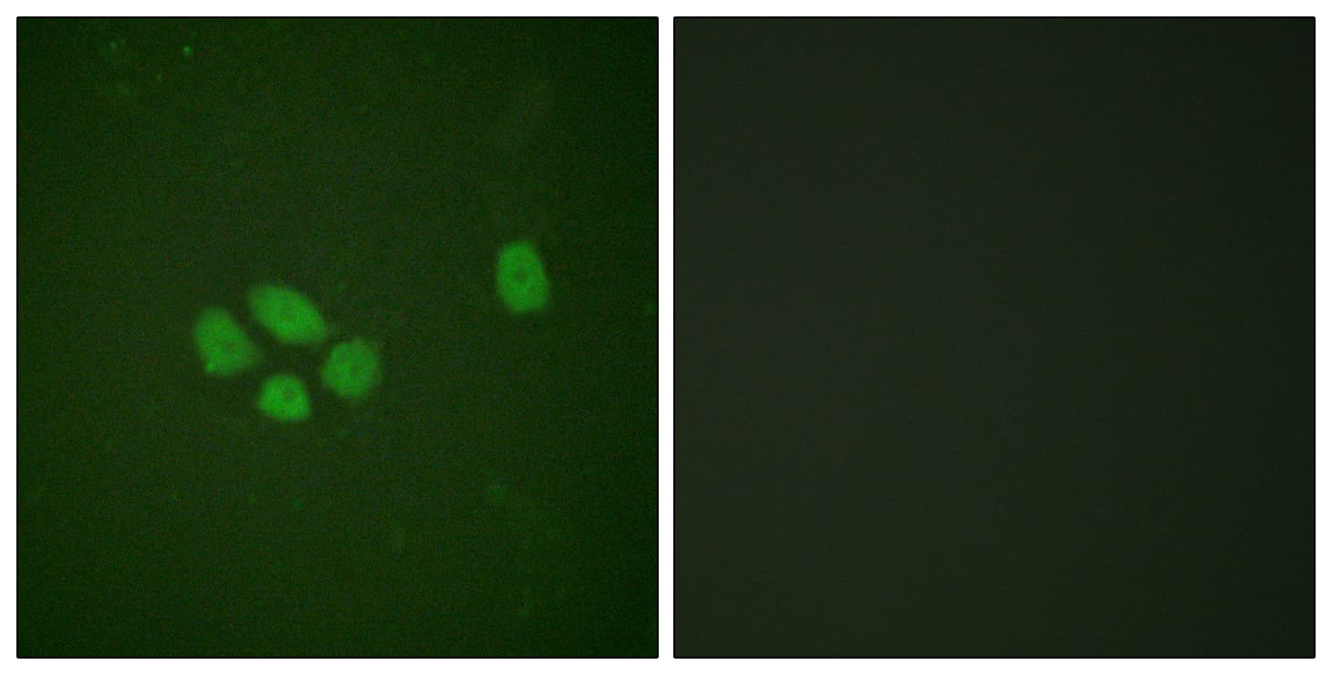 SOX9 Antibody (phospho-Ser181)
