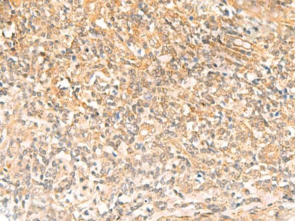 FAT10 / UBD Antibody