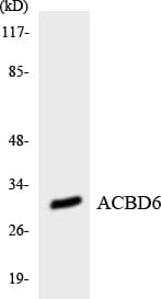 Polyclonal Rabbit anti-Human ACBD6 Antibody (aa115-164, WB)