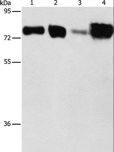 Polyclonal Rabbit anti-Human ACSL4 / FACL4 Antibody (IHC, WB)