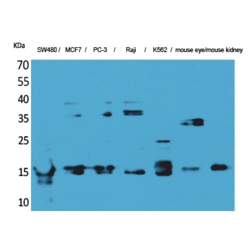 MDK / Midkine Antibody (Internal)