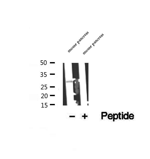 C14orf166 Antibody