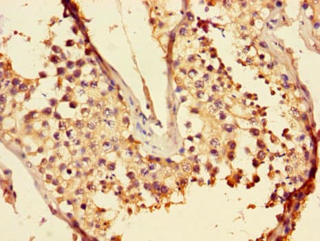 Polyclonal Rabbit anti-Human LZTFL1 Antibody (IHC, IF, WB)