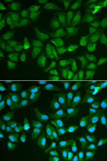 IHC-plus™ LGALS3 / Galectin 3 Antibody