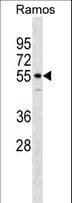 IQCB1 Antibody (aa384-411)