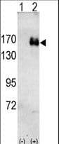 Polyclonal Rabbit anti-Human ERBB2 / HER2 Antibody (IHC, IF, WB)