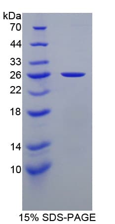 Mouse NME5 Protein (Recombinant 6His, N-terminus)