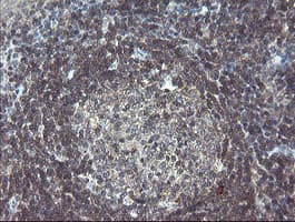 GORAB / SCYL1BP1 Antibody (aa35-394, clone OTI4F11, Carrier-free)
