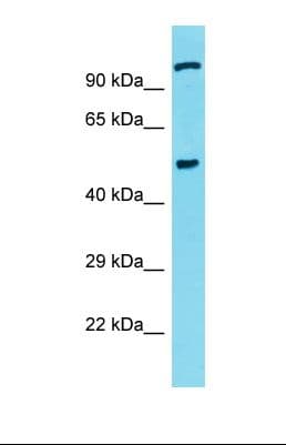Polyclonal Rabbit anti-Human CSRNP3 Antibody (aa147-196, WB)