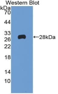 RELN / Reelin Antibody (aa2398-2608)