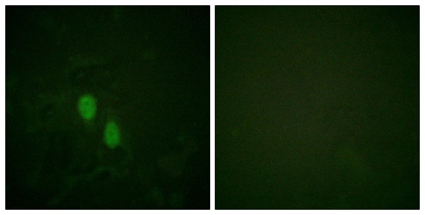 IHC-plus™ HNRNPD / AUF1 Antibody (aa49-98)