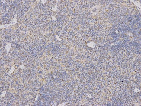 IHC-plus™ ARSA / Arylsulfatase A Antibody