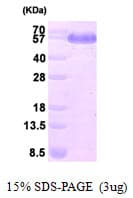 Human DLD / Diaphorase / E3 Protein (Recombinant His)