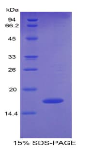 Human PTN / Pleiotrophin Protein (Recombinant His)