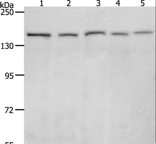 Polyclonal Rabbit anti-Human RAD50 Antibody (IHC, WB)