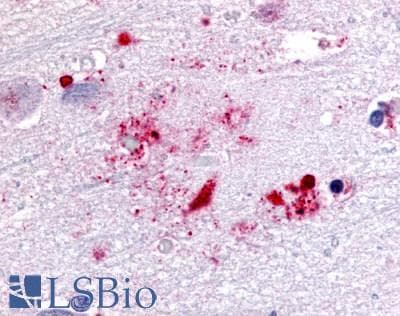 PathPlus™ GPR119 Antibody (Cytoplasmic Domain)