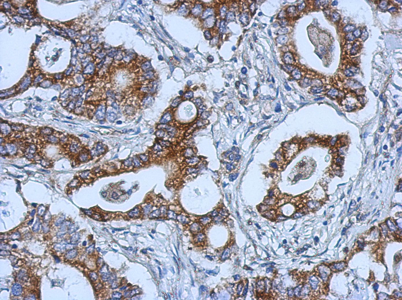 KIAA0196 Antibody (C-Terminus)