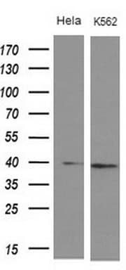 Monoclonal Mouse anti-Human DMRT1 Antibody (clone OTI1G10, Carrier-free, aa1-210, WB)
