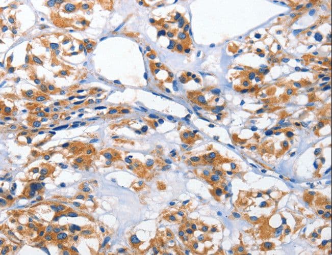 HK2 / Hexokinase 2 Antibody