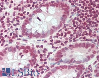 IHC-plus™ RPS6KA4 / MSK2 / RSK-B Antibody (aa692-725)