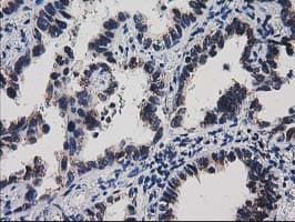 HDHD1 Antibody (clone OTI2E10, Carrier-free)