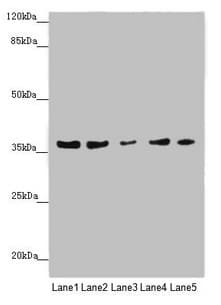 Polyclonal Rabbit anti-Human MTHFD2 Antibody (IHC, WB)
