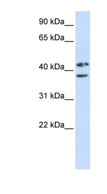 Polyclonal Rabbit anti-Human ZRANB2 / ZNF265 Antibody (aa144-193, WB)