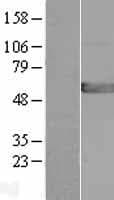 GPT2 / ALT2 Protein (Over-Expression Lysate Myc-DDK (Flag))