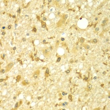 Polyclonal Rabbit anti-Human SPAG16 Antibody (IHC, WB)