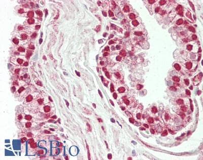 IHC-plus™ BRF1 Antibody (aa627-677)