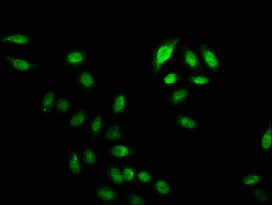 Polyclonal Rabbit anti-Human HIST1H2BN Antibody (WB)