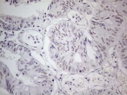 TDG / Thymine DNA Glycosylase Antibody (aa160-253, clone OTI3C11)