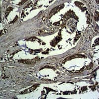 Polyclonal Rabbit anti-Mouse CTNNB1 / Beta Catenin Antibody (IHC, WB)