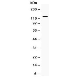 NOS2 / iNOS Antibody