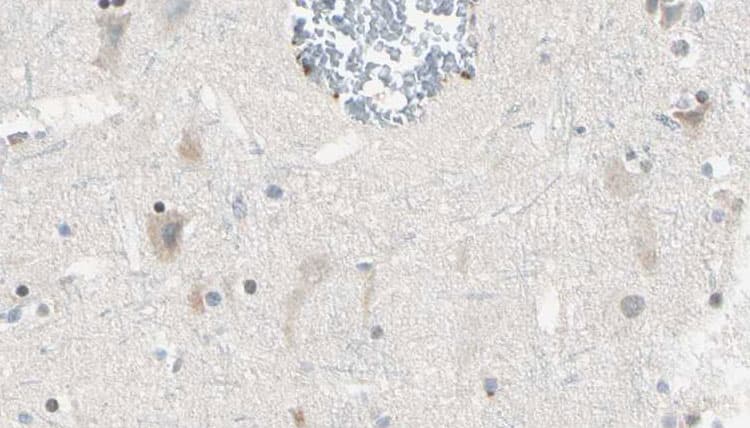 GRIA1 / GLUR1 Antibody