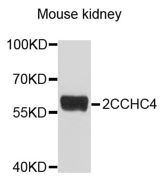 ZCCHC4 Antibody