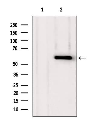 PHGDH Antibody