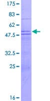 Human MED8 Protein (Recombinant GST)