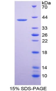 Human CXCL11 Protein (Recombinant His-GST)