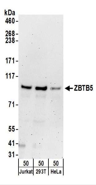 Polyclonal Rabbit anti-Human ZBTB5 Antibody (aa200-250, WB)